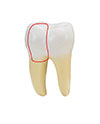 Visalia Endodontics Specialty Dental Group | Apicoectomy, Microscopes and Cracked Teeth